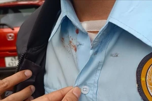 Vụ cướp ngân hàng ở Lâm Đồng: Bảo vệ bị bắn sượt qua ngực