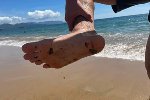 Dầu vón cục tràn vào bờ biển Nha Trang, dính vào người tắm biển