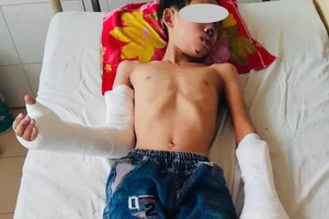 Cấp cứu bé trai 13 tuổi thương tích đầy mình vì tự chế tạo pháo