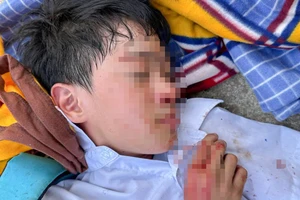 Công an thông tin về việc 1 học sinh lớp 6 bị tấn công