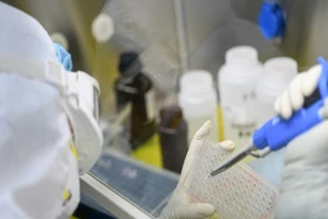 Các nhà khoa học trên thế giới đang chạy đua để phát triển một loại vaccine ngừa virus COVID-19. Ảnh: BANGKOK POST 