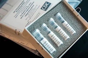 Mỹ đang rất cần các bộ kit xét nghiệm để xét nghiệm COVID-19 cho dân. Ảnh: CDC
