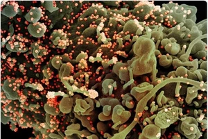 Ảnh quét màu của một tế bào bị nhiễm các hạt virus SARS-CoV-2 trình chiếu trên máy tính.