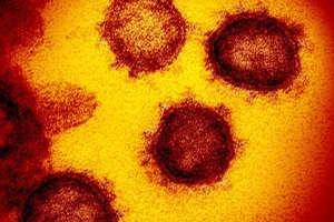 Virus SARS-CoV-2 dưới kính hiển vi điện tử. Ảnh: AFP