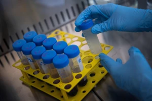 Nan giải nỗ lực tìm nguồn gốc virus gây dịch COVID-19