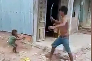 Kẻ bạo hành con gái 6 tuổi dã man ở Sóc Trăng khai gì?