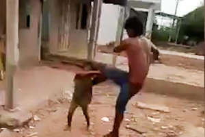 Tạm giam kẻ bạo hành con gái 6 tuổi dã man ở Sóc Trăng