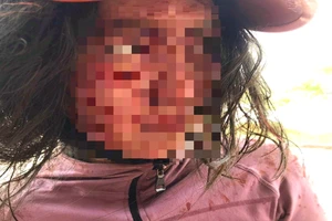 1 phụ nữ bị rạch mặt trong lúc đi photo giấy tờ để ly hôn