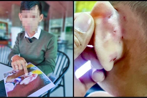 Kiên Giang: Khởi tố cô giáo bạo hành trẻ khi cho ăn