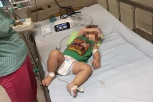 Trong nửa tháng, một gia đình mất hai con vì bệnh whitmore