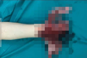 Ảnh: Bệnh viện cung cấp