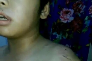 Bé 9 tuổi bị mẹ đánh nhập viện vì đọc kinh không thuộc