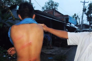 1 thanh niên nghi bị chủ nợ cho người hành hung