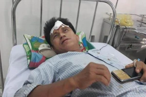 Nạn nhân kể lại lúc xe lao vực ở đèo Lò Xo