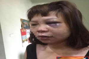 Triệu tập người chồng đánh vợ dã man ở Quảng Ninh 