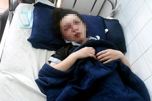 Tạm giữ 4 phụ nữ đánh hội đồng nữ nhân viên spa