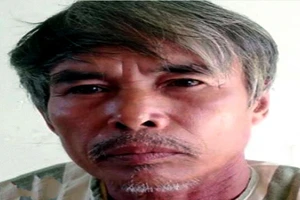 Đập vỏ chai bia vào mắt đồng nghiệp khi ngồi nhậu