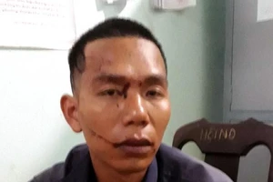 Bắt tại trận vợ ngoại tình, chồng chém tử vong tình địch