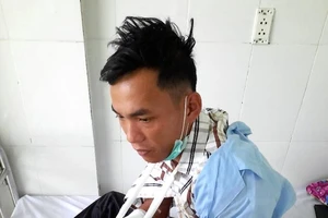 Một bảo vệ rừng bị chém đứt gân tay