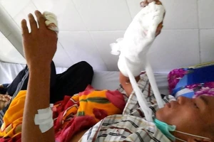 Làm rõ vụ cán bộ rừng bị chém đứt gân tay