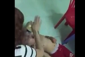 Trẻ bị bạo hành: Tổn hại và di chứng khủng khiếp 