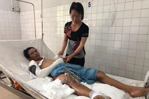 Tai nạn kinh hoàng khiến nam công nhân đứt lìa đùi phải