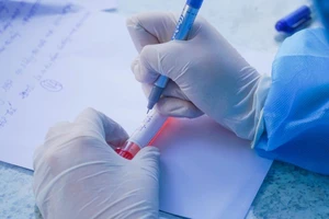 1 ca COVID-19 ở Đà Nẵng từng đến TP.HCM du lịch, đi nhiều nơi