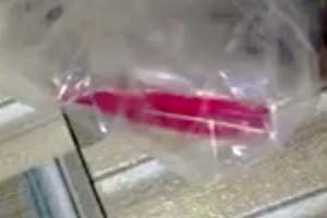 Cứu sống cô gái bị ngộ độc thuốc diệt chuột có độc tính cực cao