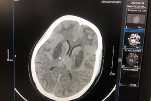 Vụ nhiễm độc methanol ở Bắc Ninh: Chuyên gia cảnh báo nguy cơ và cách phòng tránh