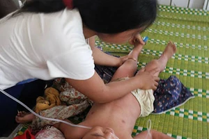 Ong rừng tấn công lớp học, 17 học sinh phải nhập viện