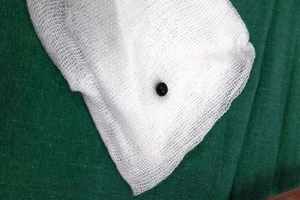 Bé 8 tuổi trúng đạn từ súng tự chế của hàng xóm