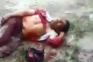 Bác xe ôm bị cướp đâm, bò ra quốc lộ kêu cứu