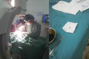 Bé trai 16 tháng tuổi bị viên bi xe đạp găm vào phổi