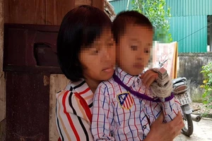 Cô giáo bị phụ huynh tố đánh gãy xương ngón tay của trò