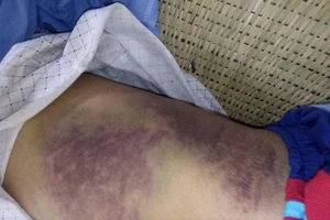 Con đánh cha bầm người, mẻ bánh chè?