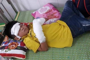 Điện thoại phát nổ, bé 7 tuổi dập nát bàn tay 