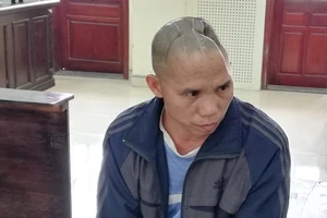 Bị mất nửa hộp sọ vẫn lãnh án về tội giết người