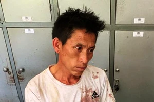 Bắt kẻ ôm súng và lựu đạn buôn ma túy, 1 cảnh sát bị thương 