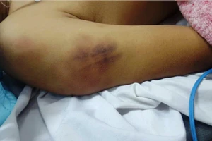 Nghi phạm tử vong bất thường sau 5 ngày tạm giữ