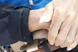 Làm rõ cái chết người đàn ông có ống khóa mắc ở đai nịt quần