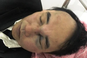 Phản ánh xe chắn lối vào nhà, nam bác sĩ bị đánh nhập viện