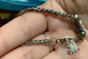  Nghệ An: Bé gái 3 tuổi đi ngoài ra chiếc vòng bạc 