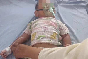 Cứu bé 16 tháng tuổi uống dầu hỏa đựng trong chai nước khoáng