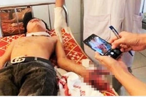 Laptop phát nổ kinh hoàng, 3 học sinh nhập viện cấp cứu