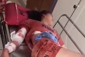 Con gái bị thương nặng khi lao vào can ngăn cha sát hại mẹ