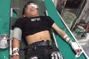 2 xe máy tông nhau, 3 học sinh tử vong một em trọng thương