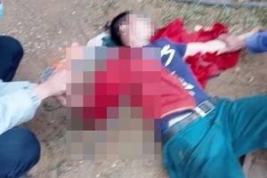  Bị cây sắt đâm xuyên qua ngực, người đàn ông nguy kịch