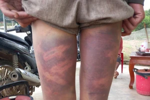 Đánh dân, một công an viên bị thôi việc, trung úy công an khác bị cảnh cáo