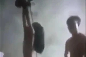 Phẫn nộ: Bé gái bị đánh, lột quần áo, treo hai tay lên trần nhà 