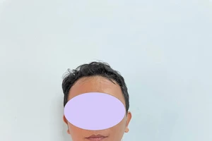 Công an phát thông báo tìm người cai nghiện ma túy bỏ trốn